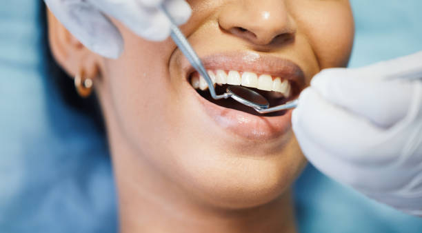 Best Cracked Tooth Emergency Dentist  in Centerville, UT